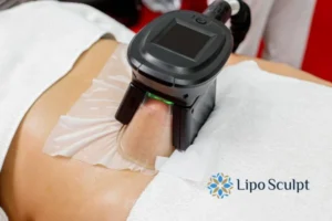 Fat freezing at home from Lipo Sculpt Henley In Arden